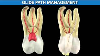 Shaping the Future in Endodontics with Dr Ruddle and Dr West [upl. by Willdon]