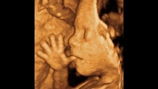 3D fetal ultrasound  amazing things fetuses do in the womb  Dr I Shapiro [upl. by Forta]