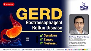 Gastroesophageal reflux disease GERD  Symptoms Causes and Treatment  Dr Ravula Phani Krishna [upl. by Rodolph]