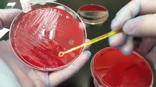 Microbiology Bacteroides fragilis biochemical testing and colonial growth [upl. by Inalaehak]