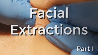 Facial Extractions  Part I [upl. by Alverta]