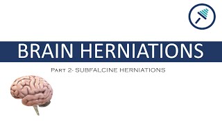 BRAIN HERNIATIONS 24 Subfalcine Herniations [upl. by Grethel307]