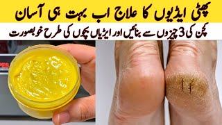 Remove Cracked Heels At Home  Get Beautiful Feet Permanently  Home Remedies [upl. by Esille]