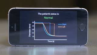 PupilScreen Using Smartphones to Assess Traumatic Brain Injury [upl. by Enerehs]