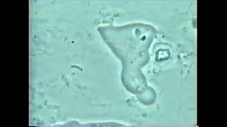 Periodontitis pathogen parasite Entamoeba gingivalis in 100 [upl. by Ethban]