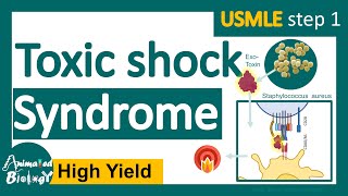 Toxic shock syndrome  What causes toxic shock syndrome signs and symptoms of Toxic shock syndrome [upl. by Eirallih]