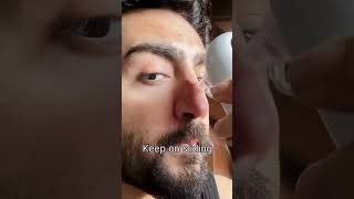 How to remove blackheads at home  Blackheads removal tool  Blackheads kaise hatein blackheads [upl. by Reidar]