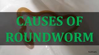 CAUSES OF ROUNDWORM [upl. by Aurilia]