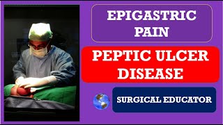 PEPTIC ULCER DISEASE How To DIAGNOSE amp TREAT EPIGASTRIC PAIN [upl. by Venezia560]