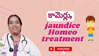 కామెర్లు jaundiceHomeo treatment SudharamanHomeoClinic [upl. by Anonyw]