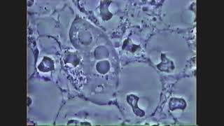 Periodontal disease microbiota Amibian breakdown Accelerated 8x [upl. by Born]