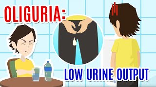 Oliguria poor urine production Causes diagnosis and care [upl. by Nicholson]