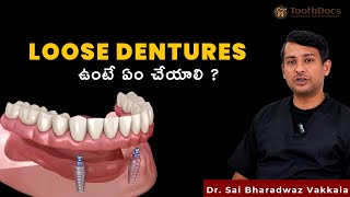 LOOSE DENTURES ఉంటే ఏం చేయాలి  పెట్టుడు పళ్ళు వల్ల లాభాలు ఏంటి   Tooth Docs Hyderabad [upl. by Htide]