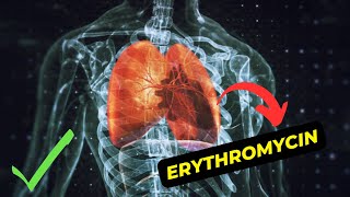 The Benefits of Erythromycin An Overview of Antibiotic Treatment [upl. by Grannie360]