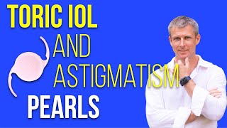 Toric IOLs and astigmatism perls for cataract surgery [upl. by Rebecka]