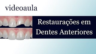 9º Aula Dentística  Restaurações em Dentes Anteriores [upl. by Gallard]