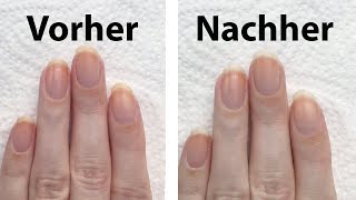 3 Tipps im Test um vergilbte Fingernägel aufzuhellen  seni Nageldesign [upl. by Hanako828]