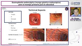 Sesión mensual Gastroplastia endoscópica para el manejo primario para la obesidad  7 de julio 2022 [upl. by Bobker]