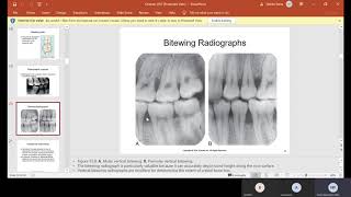 CH 55 Periodontics [upl. by Ainegue486]