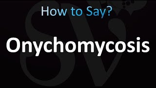 How to Pronounce Onychomycosis correctly [upl. by Ennayelhsa]