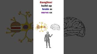 TaySachs Disease  Easy to remember Animation of Lysosomal Disorder shorts short medical [upl. by Kcerred]