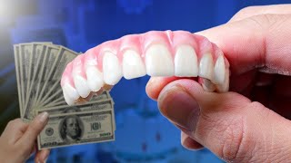 Why Dental Implants Might Cost You More Than You Think [upl. by Wilek296]