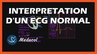 Electrocardiogramme ECG  interpretation dun ECG normal [upl. by Idelia100]