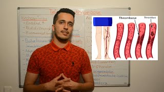 Diagnostik der Tiefen Venenthrombose TVT  Angiologie  Innere Medizin [upl. by Ennaj255]