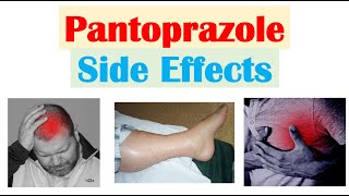 Pantoprazole amp Omeprazole Side Effects Including Nutrient Deficiencies amp Infections [upl. by Toiboid841]