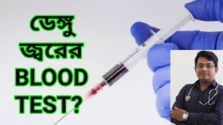 ডেঙ্গু জ্বরের টেস্ট চিকিৎসা ও সতর্কতা  Dengue fever blood test treatement amp awarenessVlog37 [upl. by Aillemac787]