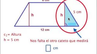 Altura de un trapecio isósceles [upl. by Herra]