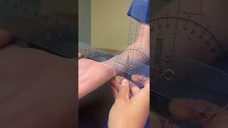 Goniometry forearm supination [upl. by Ymer759]