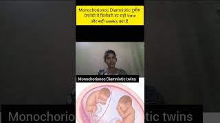 monochorionoc Diamniotic twins pregnancy me delivery ka sahi time kya hota h shortstwinsdelivery [upl. by Yecaw]