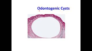 Odontogenic Cysts [upl. by Dunham]