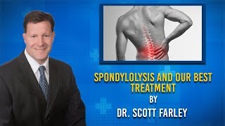 WHAT IS SPONDYLOLYSIS AND HOW DO WE TREAT AT COMPREHENSIVE SPINE CENTER OF DALLAS [upl. by Mindi927]