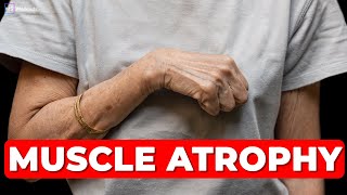 Reverse Muscle Atrophy  3 Effective Exercises [upl. by Mulderig502]