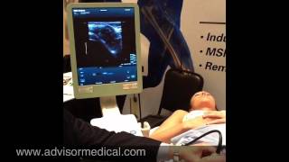 Ultrasound Guided Hip Injection [upl. by Jaycee]