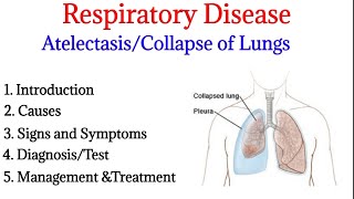 Atelectasis  Introduction causes signs ampsymptoms diagnosis and treatment  Respiratory disease [upl. by Viki616]