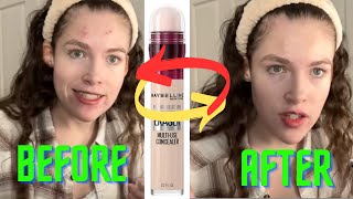 Maybelline Instant Age Rewind Eraser Dark Circles and acne treatment  Maybelline Eraser Review [upl. by Alleul918]