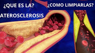 Cómo Prevenir la Aterosclerosis [upl. by Taite801]