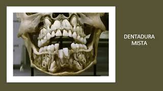 Aula O Pediátrica I Características da dentição decídua 2ª Parte [upl. by Hameerak651]