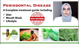 Gingivitis  Periodontal Disease Natural Treatment [upl. by Loise]