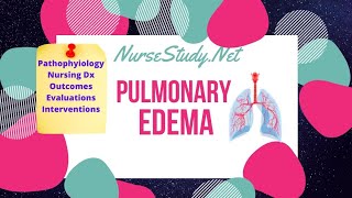 Pulmonary Edema Pathophysiology Care Plan for Nursing Students [upl. by Zurciram35]