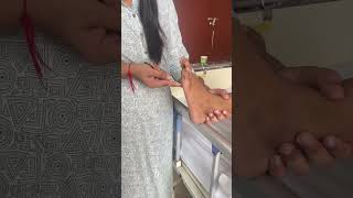 Plantar reflex  Extention of toe  Babinski sign  Positive bkdrmuskaan [upl. by Kovacs735]