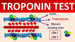 Troponin test and its significance [upl. by Jacey]