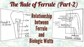 Ferrule Effect Part2 Relationship between Ferrule and Biologic Width [upl. by Yehs]