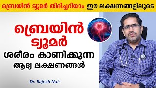 ബ്രെയിൻ ട്യൂമർ ശരീരം കാണിക്കുന്ന ആദ്യ ലക്ഷണങ്ങൾ  Brain Tumor Malayalam  Arogyam [upl. by Vena]