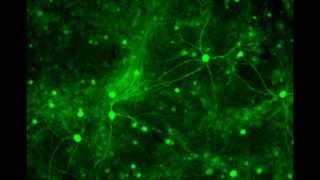 Neuronal synchronized firing  Calcium oscillation in neurons [upl. by Lyreb]