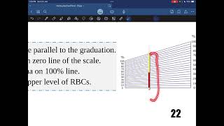 Hematocrit value  Practical hematology  Dr Saiko [upl. by Pejsach301]