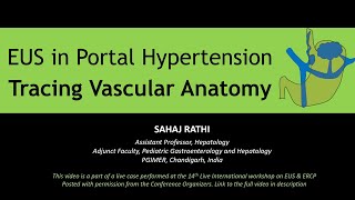 Endoscopic Ultrasound Evaluation of Splenoportal Axis in Portal Hypertension [upl. by Nerw]